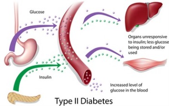 feline-diabetes-type2